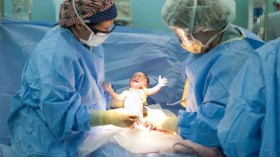 الولادة القيصرية تهدد طفلك بالسمنة