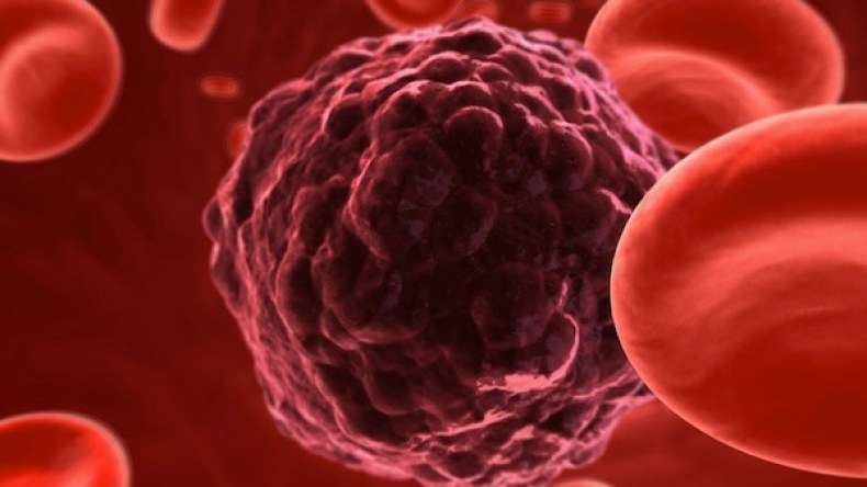 48 ‬ألف مصاب بالسرطان في‮ ‬الجزائر سنويا