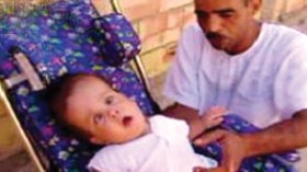 مرض “سبينا بيفيدا” وولد عباس يسوّدان حياة الصبيّ بدر الدين منذ ثلاث سنوات