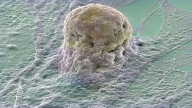 Des chercheurs japonais ont réussi à générer un foie humain à partir de cellules souches pluripotentes