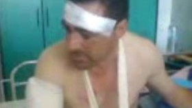 الإرهابيون  استعملوا  القذائف  بطريقة  عشوائية  ولم  يكترثوا للسكان