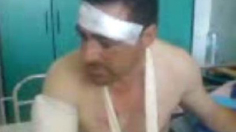 الإرهابيون  استعملوا  القذائف  بطريقة  عشوائية  ولم  يكترثوا للسكان