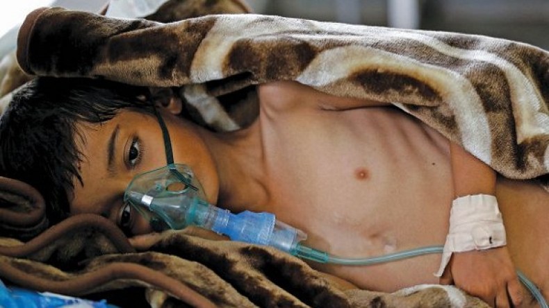 ارتفاع ضحايا الكوليرا في اليمن إلى 1732 وفاة