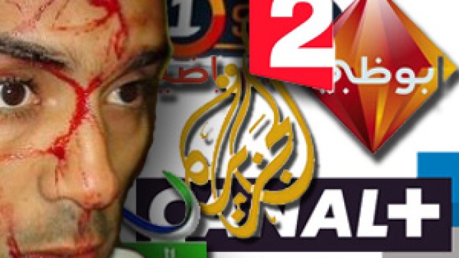 قناة “فرانس 2” تفضح الإعلام المصري وتعري فنانيهم