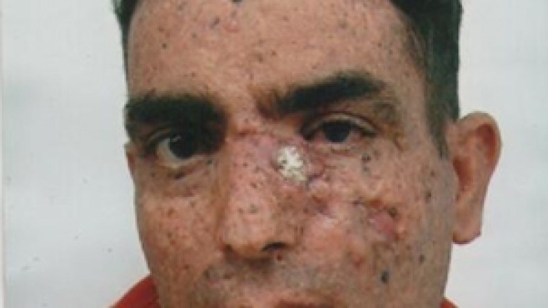 عندليب الأغنية الشاوية، حسان نمر، يناشد مسؤولي الثقافة لإنقاذ حياته