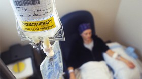 أطباء ينتقدون “الطبقية” في علاج السرطان في الجزائر