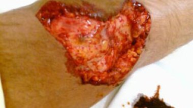 150 morsures et 30 mille piqûres de scorpions anuellement en Algérie