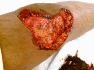 150 morsures et 30 mille piqûres de scorpions anuellement en Algérie