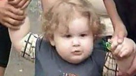 دراسة: الأطفال البدناء أكثر عرضة للإصابة بالتهاب الغدة الدرقية