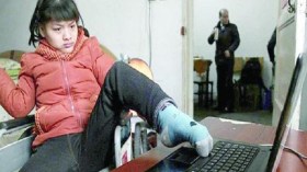 شابة تكتب روايتها بساقٍ واحدة فقط