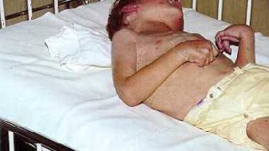 10 000 épileptiques à Alger