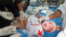 التخدير الجزئي ممنوع في عمليات الختان