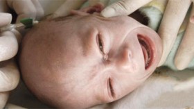 أطفال السرطان.. عندما تدق غرفة الموت وتغلق أبواب الرحمة