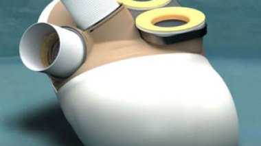 USA: les autorités approuvent le premier cœur artificiel pour enfants