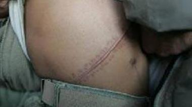 Organ trafficking network dismantled in Algeria