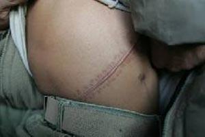 Organ trafficking network dismantled in Algeria