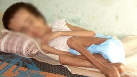 المعوقون والمسنون: معاناة مع ” الحفّاظات “