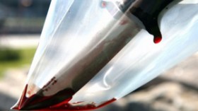 جرحى في معركة دامية بالسيوف والسواطير بمعسكر