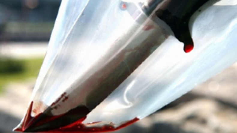 جرحى في معركة دامية بالسيوف والسواطير بمعسكر