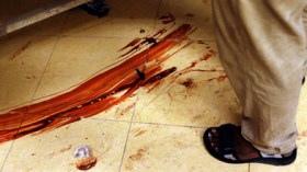 رب أسرة يعذب ابنتيه بشفرة حلاقة و يزج بولده في السجن