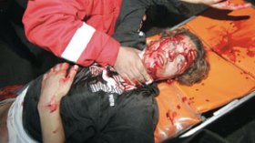 المقاومة تُجبر الصهاينة على الانسحاب من تل الهوى