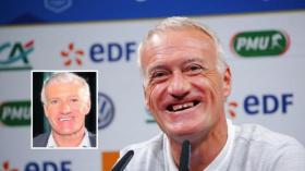 مدرب فرنسا: أُركّز على عملي وليس على البذلة والشَّعر وطاقم الأسنان