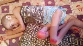 النابغة شعيب يتوقف عن الدراسة بسبب مرض غريب