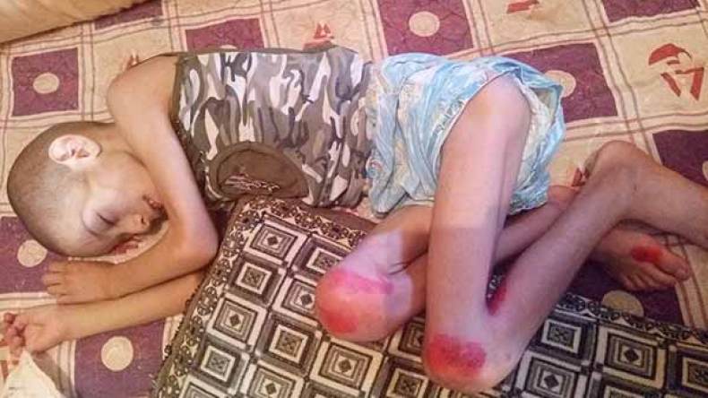 النابغة شعيب يتوقف عن الدراسة بسبب مرض غريب