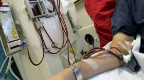 ظروف معقدة لمرضى تصفية الكلى بأدرار