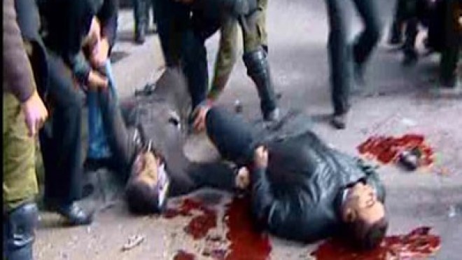 25 قتيلا  و46 جريحا في تفجير انتحاري في دمشق