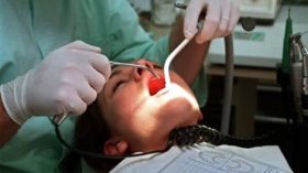 جراحو الأسنان يرفضون علاج المصابين بالهيموفيليا