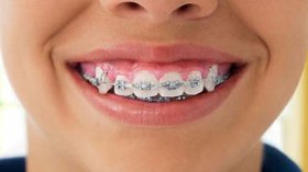 الأخصائيون الجزائريون يتعرفون على آخر تقنيات تقويم الأسنان