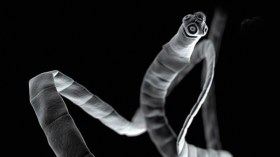 أمريكية تطعم ابنتها ديداناً لإنقاص وزنها