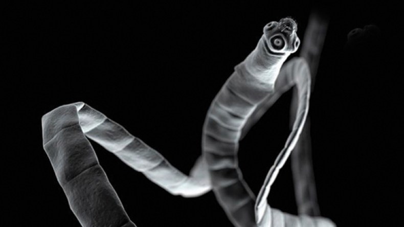 أمريكية تطعم ابنتها ديداناً لإنقاص وزنها