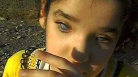 محتال مصري يسرق صورة طفلة من “الشروق” ويستغلها لجمع التبرعات