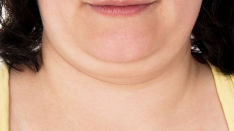 إذا كنت تعانين من “الذقن المزدوج” فإليك الحل!