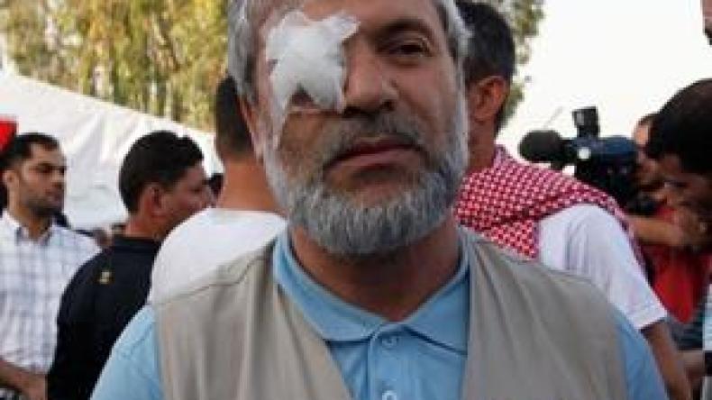 هكذا  أصيب  نائب  جزائري  بالرصاصة  الأولى .. والأتراك  قاوموا  حتى  النهاية