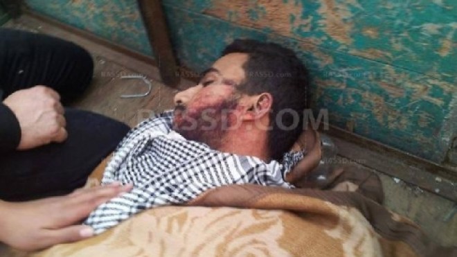 الفلول يحتفلون بذكرى الثورة.. والثوار تخاذلوا أمام دماء رفقائهم