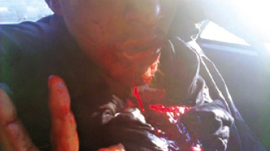 Exclusivité Echorouk : des images « effroyables » du carnage perpétré par l’armée marocaine à El Ayoun