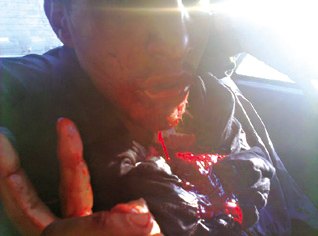 Exclusivité Echorouk : des images « effroyables » du carnage perpétré par l’armée marocaine à El Ayoun