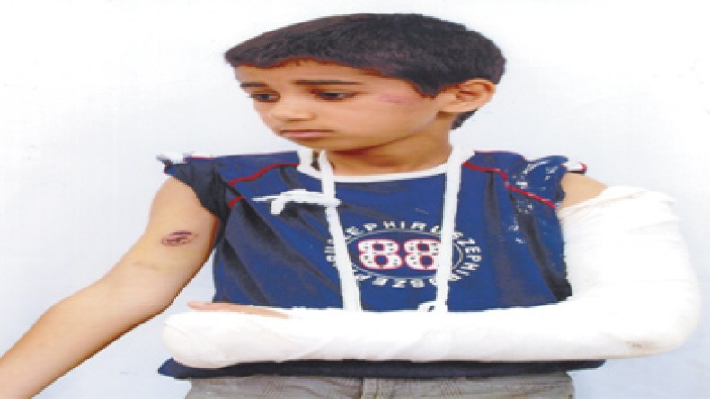 مدير متوسطة يعذب تلميذه ويكسر ذراعه لأنه نسي المئزر