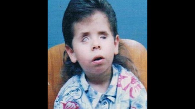 خطأ طبي يحرم أنيس من الرؤية مدى الحياة