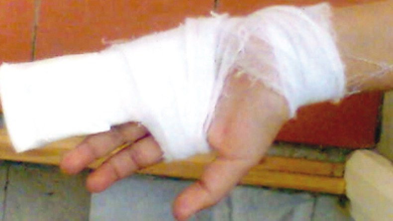 معلمة تكسر يد تلميذة لأنها لم تنجز واجبها المنزلي