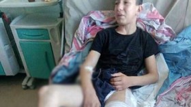 أستاذ بالمتوسط يعتدي بالضرب على تلميذ ويدخله الإنعاش في خنشلة