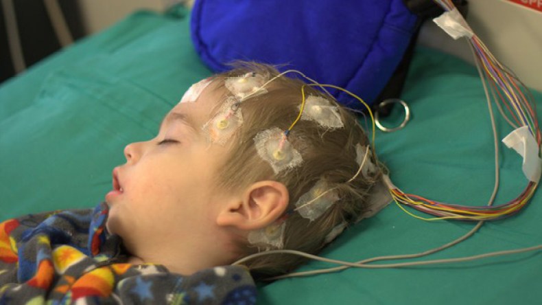 80 بالمائة من ضحايا الصرع في الجزائر هم أطفال