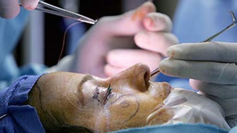 عمليات جراحية تجميلية تسبب السرطان ضحاياها ابناء الاثرياء