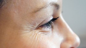 احذري.. تجاعيد العين تظهر باكرا!
