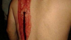 طعن مناصر من سبورتينغ بالسكّين وعودة سليماني