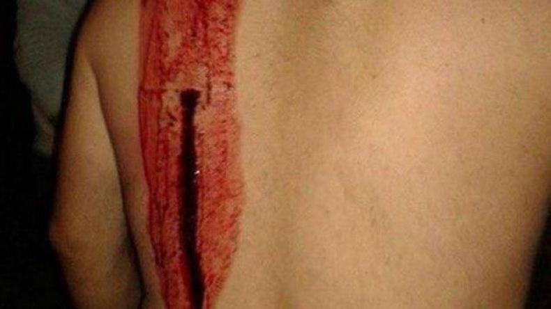 طعن مناصر من سبورتينغ بالسكّين وعودة سليماني