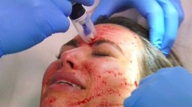 تشوهات خطيرة تصيب المرأة.. والسبب مراكز التجميل في الجزائر